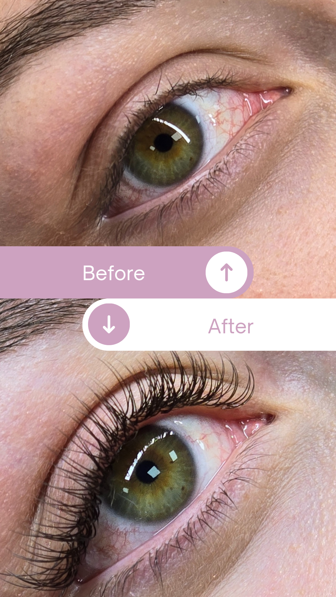 Antes y Después - Extensiones Híbridas